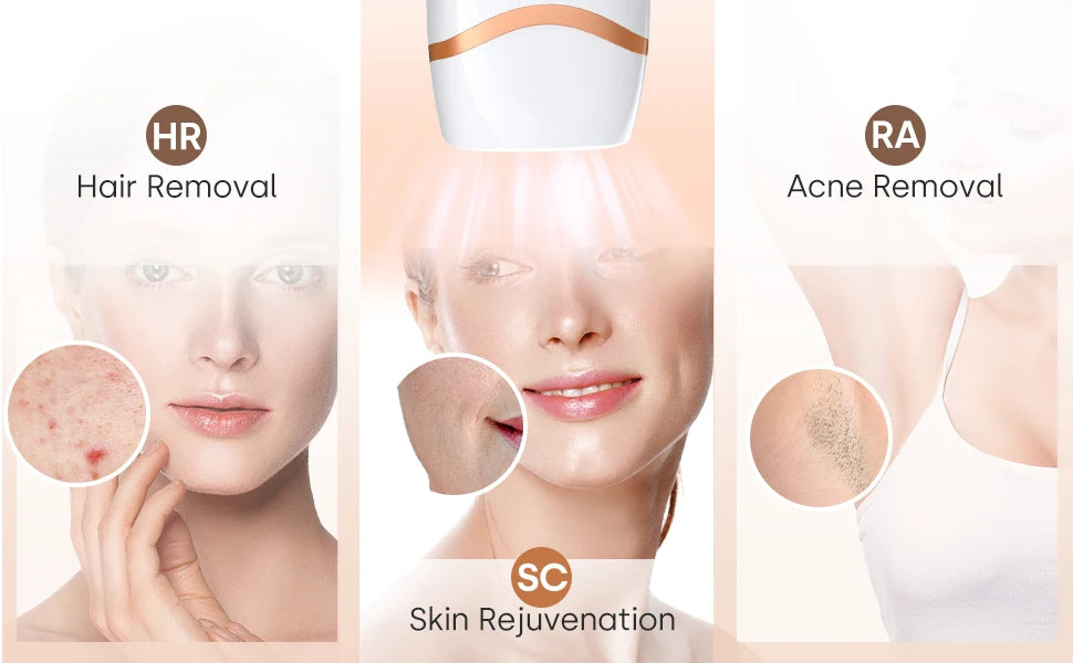 Pulsed Light Hair Removal Device – Permanent Hair Removal at Home