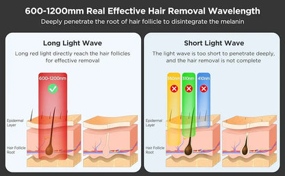 Pulsed Light Hair Removal Device – Permanent Hair Removal at Home